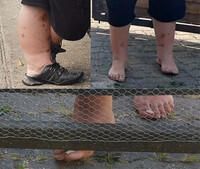 Pfostenbild